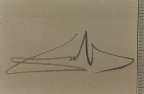 El de los roñones a la brochette