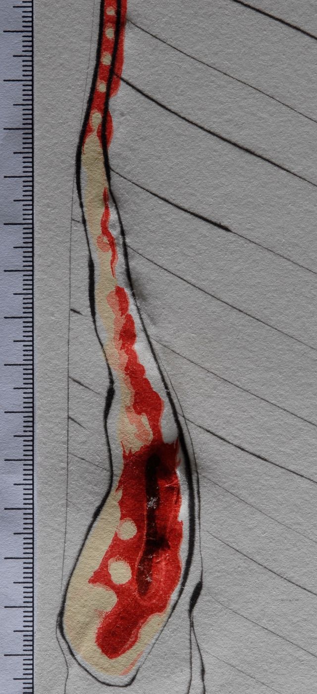 Philosophe écrasé par le cosmos