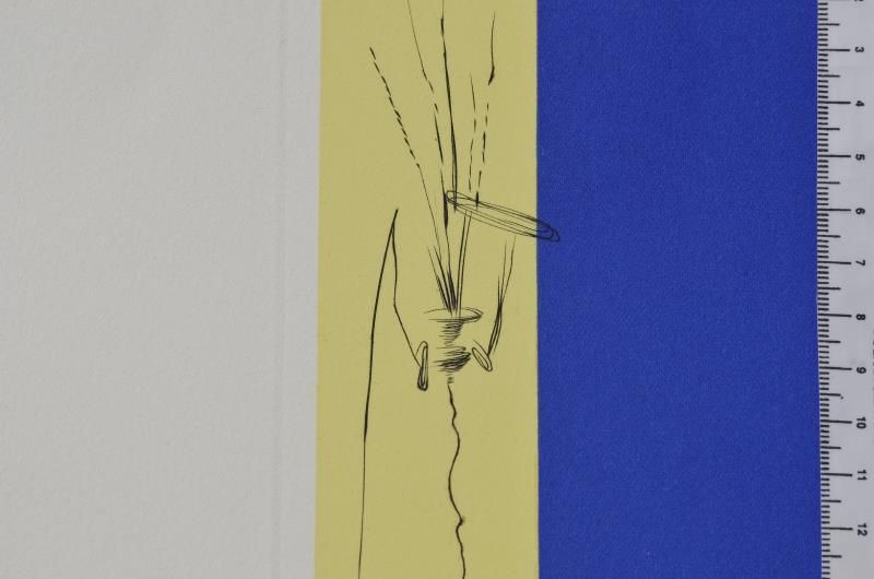 Surrealistic crutches